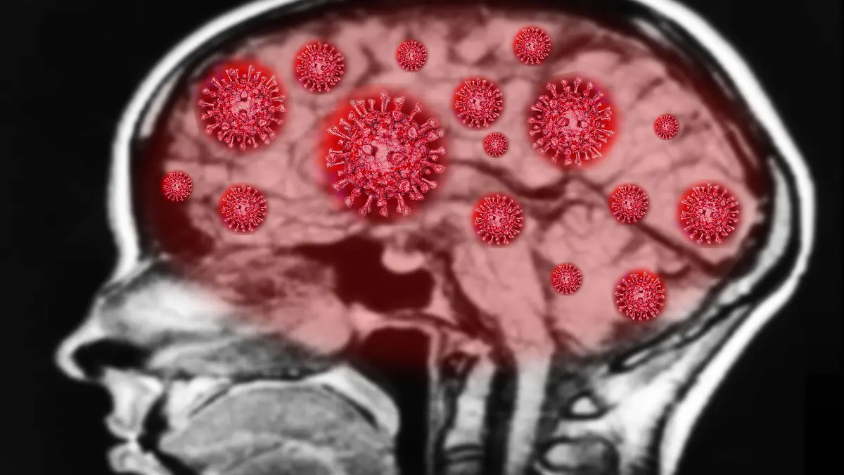 Coronavirus Gehirn