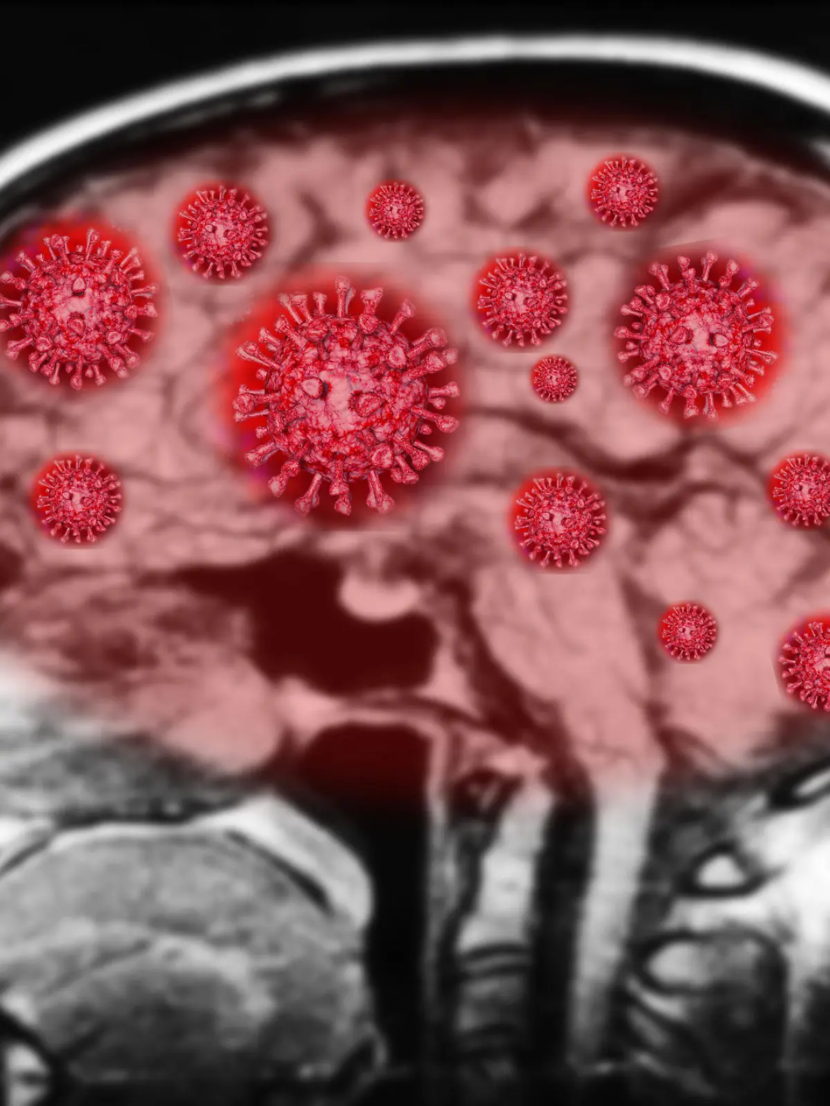 Coronavirus Gehirn