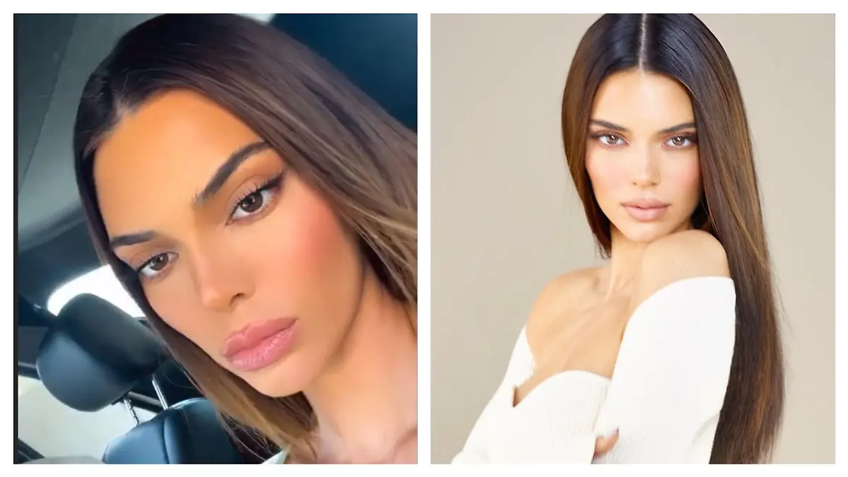 Kendall Jenner zeigt sich in ihrer Story total verändert: rechts ein älteres Bild und links ein Foto mit dickeren Lippen.