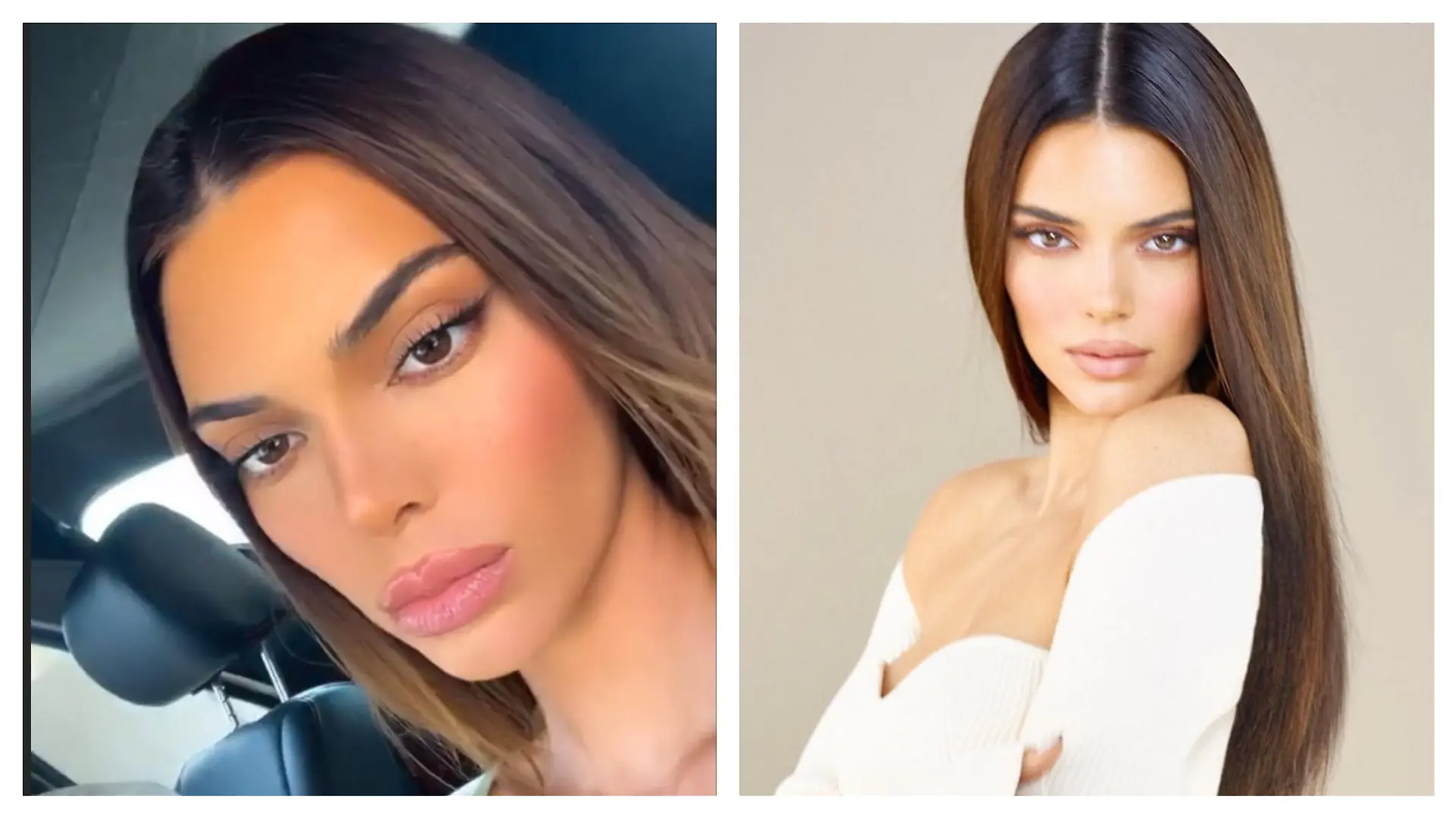 Kendall Jenner zeigt sich in ihrer Story total verändert: rechts ein älteres Bild und links ein Foto mit dickeren Lippen.