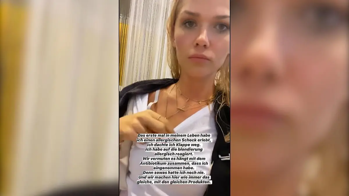 Sara Kulka bekommt beim Friseur einen allergischen Schock So dramatisch kann das Haarefärben sein