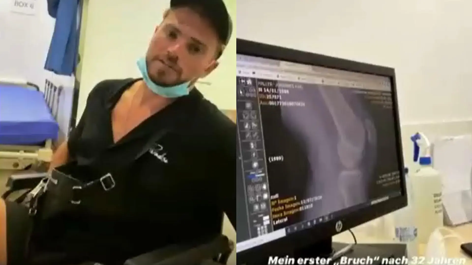 Johannes Haller im Rollstuhl (l.): Sein Knie (Röntgenbild, r.) macht ihm zu schaffen.