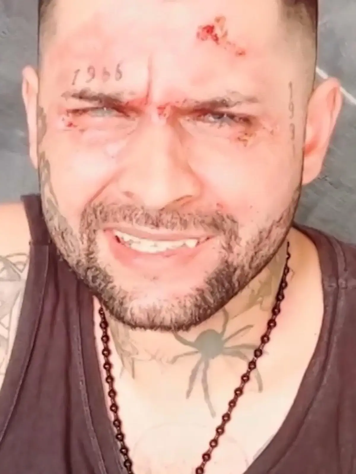 Leandro Coelho (30) ist auf dem Nachhauseweg, als ihm jemand mitten auf der Straße ätzende Säure ins Gesicht schüttet. Innerhalb weniger Sekunden ist der Brasilianer auf beiden Augen blind, sein Leben zerstört. Die Angreiferin: seine Ex-Freundin Sônia Gregorio (41), die die Tat offenbar lange geplant hat. Der 30-Jährige überlebt nur dank seines Motorradhelms.t...