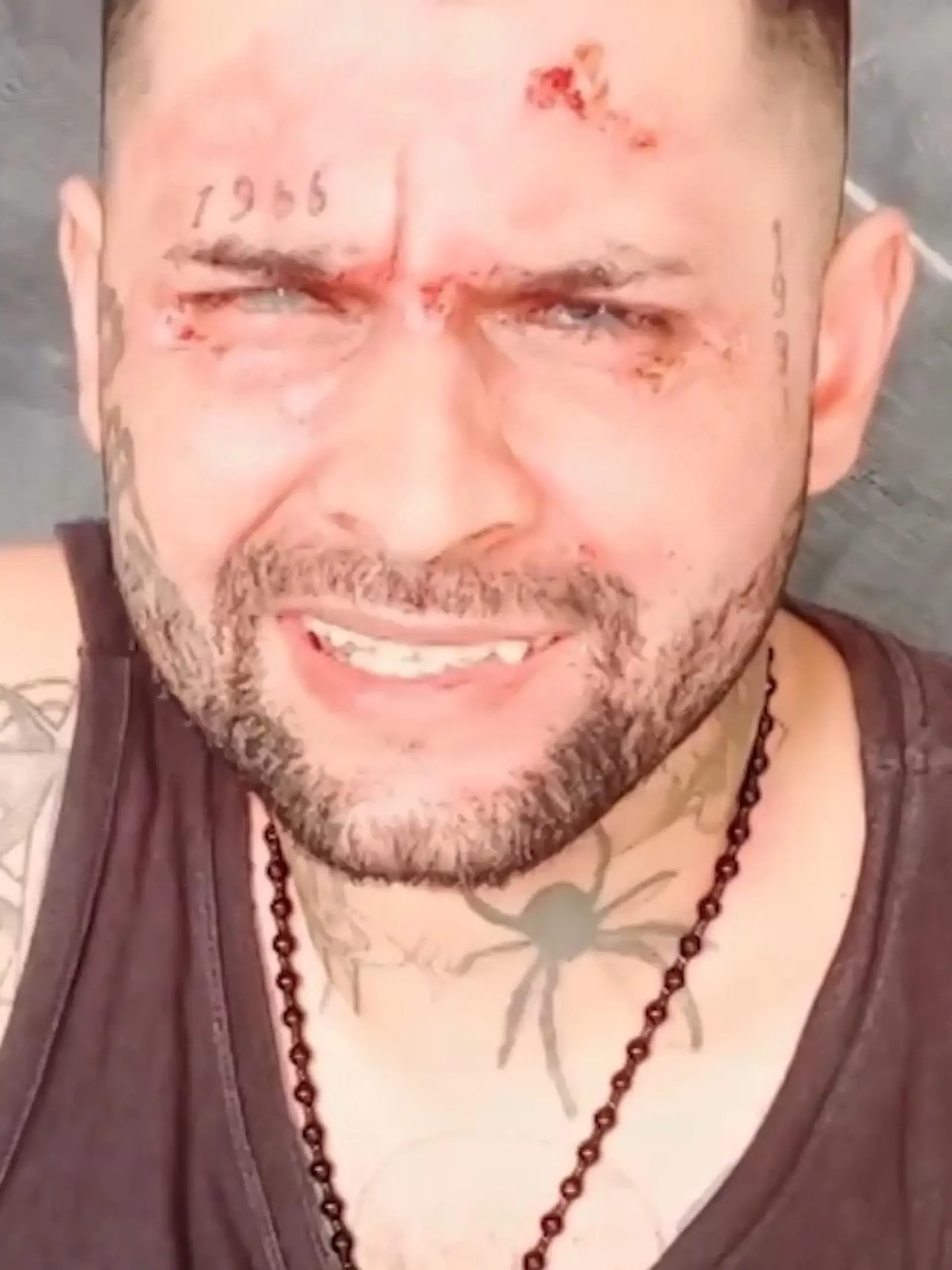Leandro Coelho (30) ist auf dem Nachhauseweg, als ihm jemand mitten auf der Straße ätzende Säure ins Gesicht schüttet. Innerhalb weniger Sekunden ist der Brasilianer auf beiden Augen blind, sein Leben zerstört. Die Angreiferin: seine Ex-Freundin Sônia Gregorio (41), die die Tat offenbar lange geplant hat. Der 30-Jährige überlebt nur dank seines Motorradhelms.t...