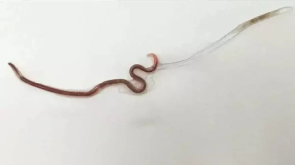 Dieser Spulwurm wurde in einem Sashimi-Stück gefunden.