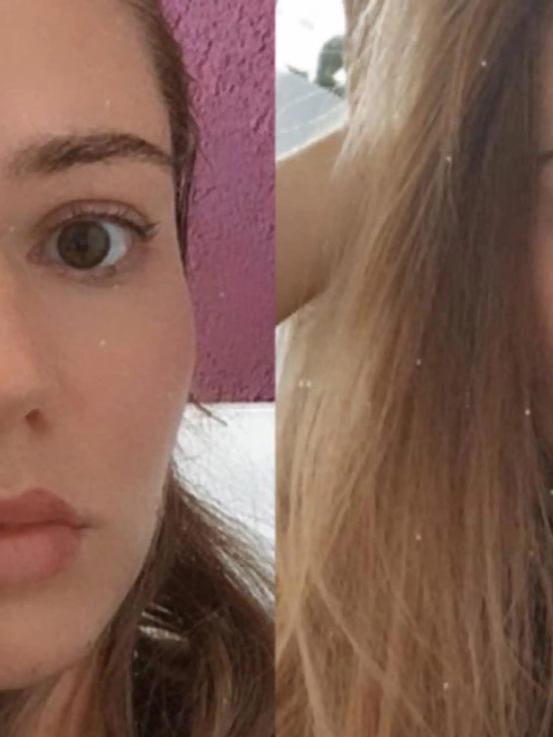 Instagramerin Eleonora Konrad aus Böblingen wollte noch mehr Perfektion in ihr schönes Gesicht bringen. Doch die Botox-Spritze, die ihre linke Augenbraue nur minimal anheben sollte, hat schockierende Folgen.