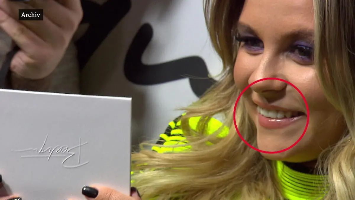 Youtuberin Dagi Bee hat sich die Lippen machen lassen Dagi Bee gesteht Beauty-Eingriff