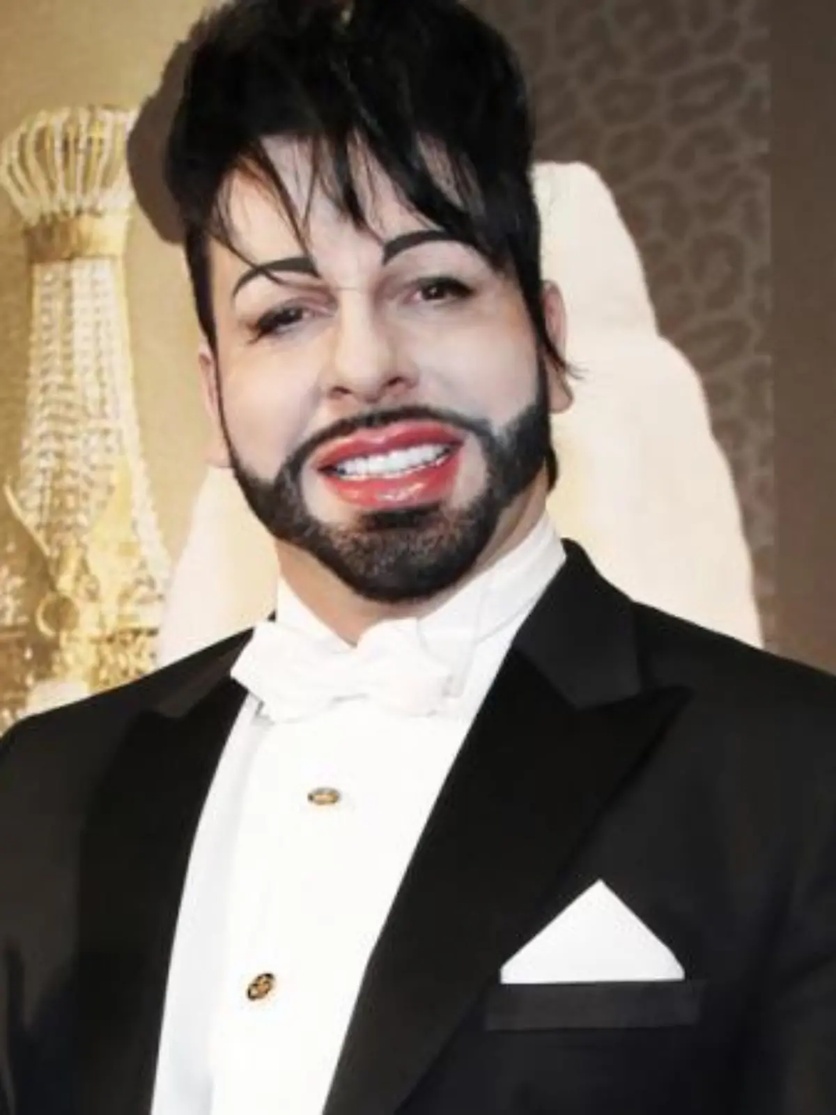 Harald Glööckler: Endlich wieder Botox!