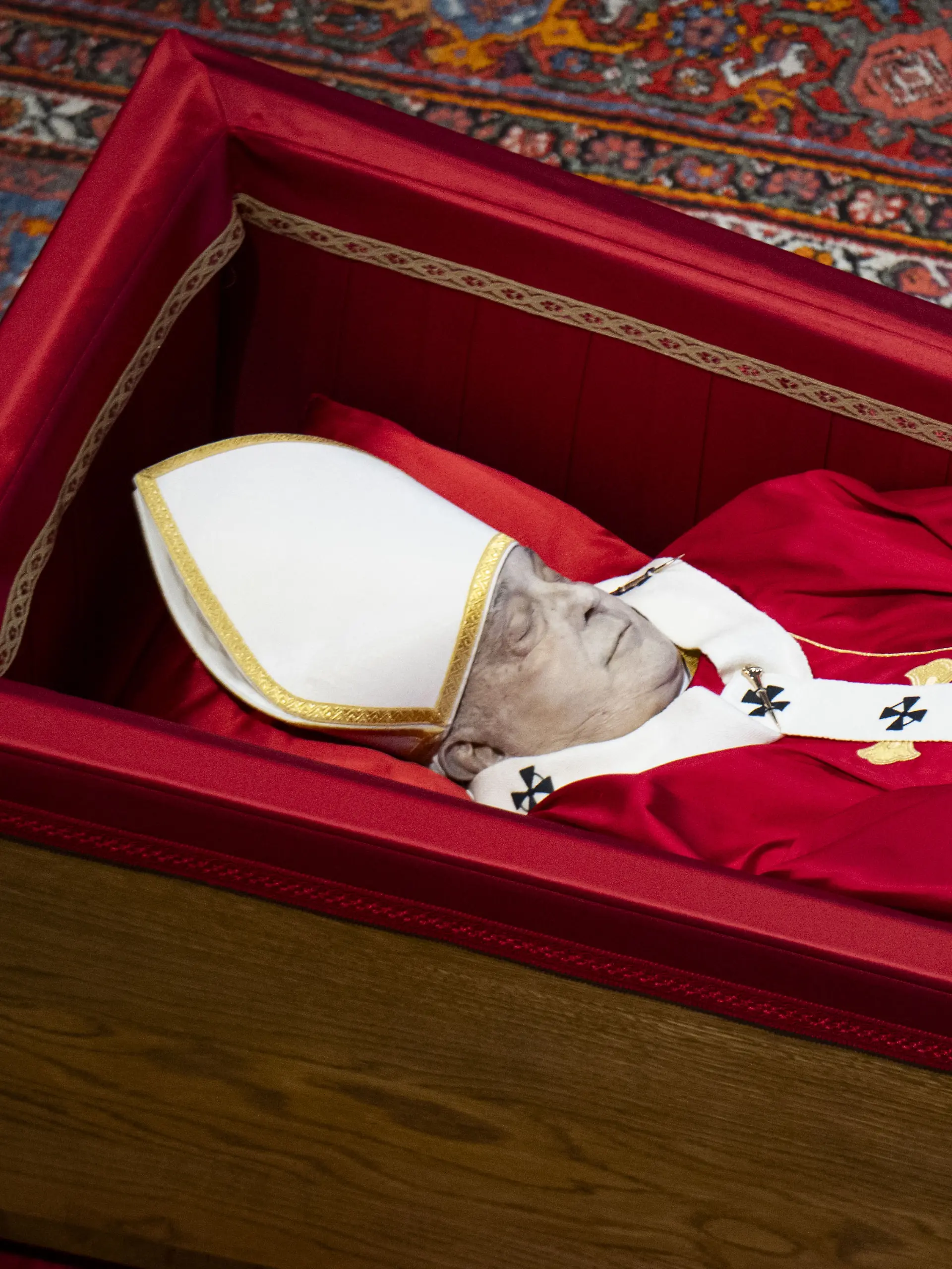 Was hat es mit den Flecken im Gesicht von Papst Franziskus auf sich?