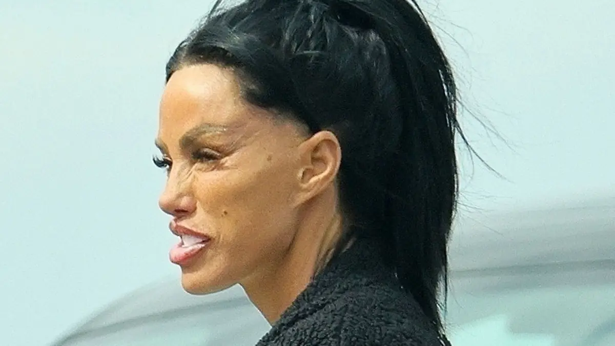 Katie Price hat sich einem Facelift für umgerechnet 11.500 Euro unterzogen. Aktuelle Bilder von ihr erschrecken ihre Fans