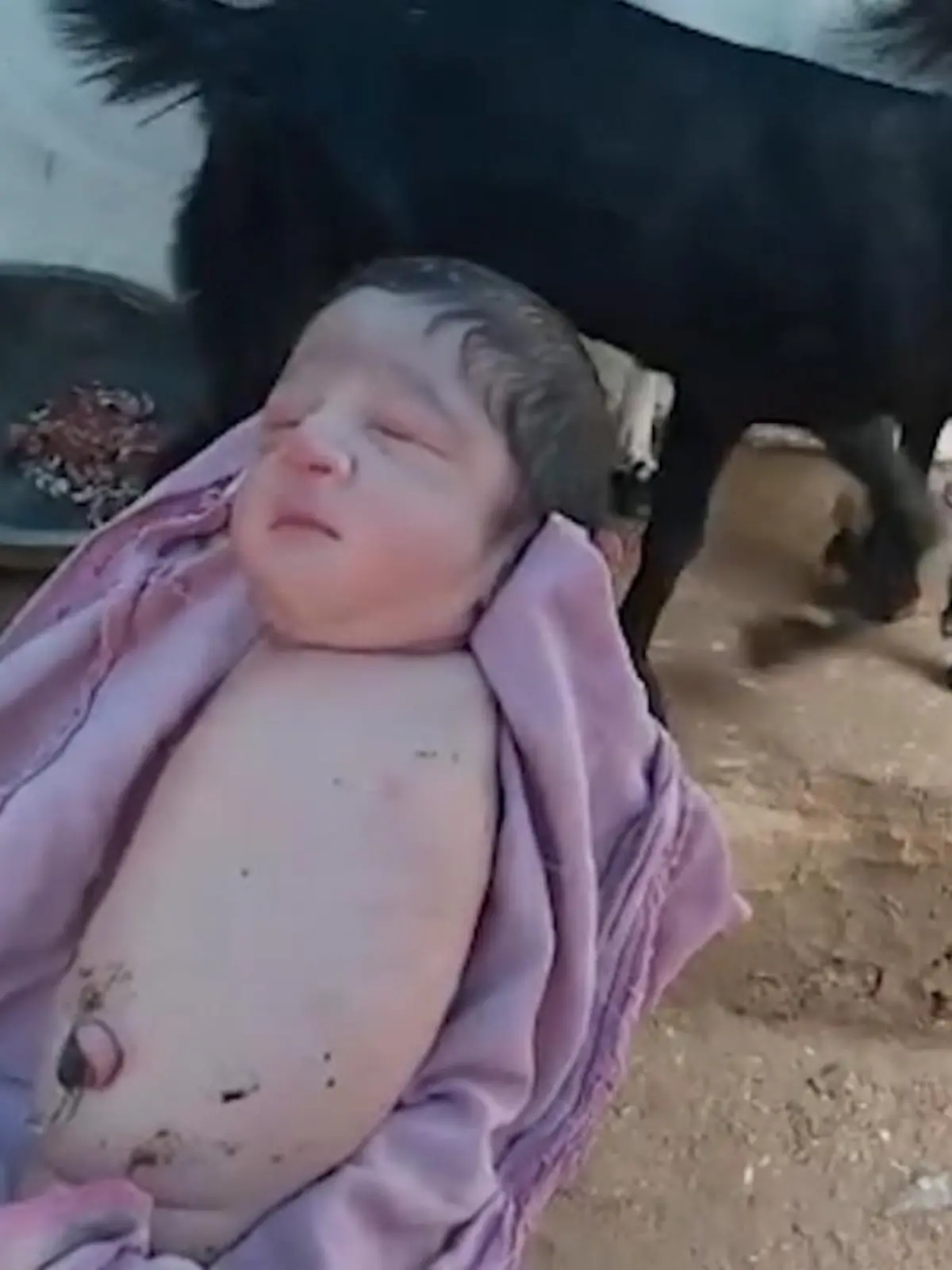 In Indien kam ein Mädchen mit einem seltenen Gendefekt zur Welt. Zwar hat die Kleine keine Arme und Beine, doch ist sie wohl auf. Hoffnung auf ein erfülltes Leben schenkt der einflussreiche Sprecher Nick Vujicic. Er verkörpert ein weiteres Beispiel für Tetraamelie. Wie stark er mit dieser Fehlbildung umgeht, zeigen wir im Video.
