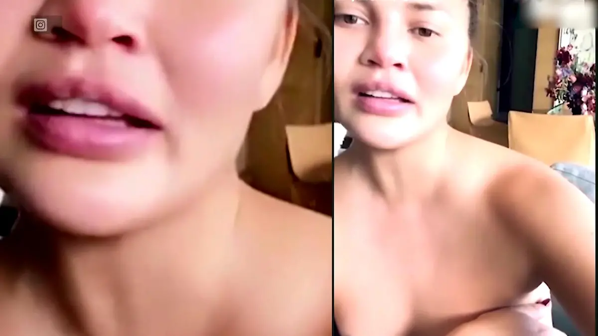 Chrissy Teigen zeigt ihre Brust nach der OP Chrissy Teigen hat die Brust-Implantate raus