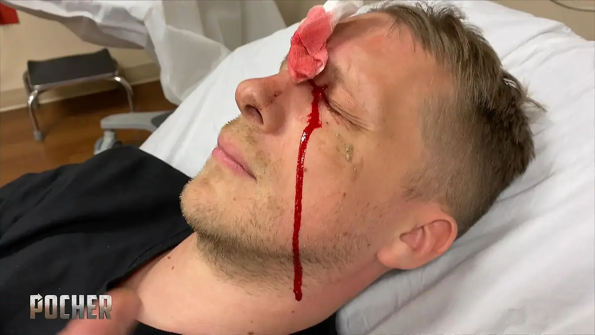 So kam es zu seiner Schuss-Verletzung Olli Pocher zeigt Ausschnitt