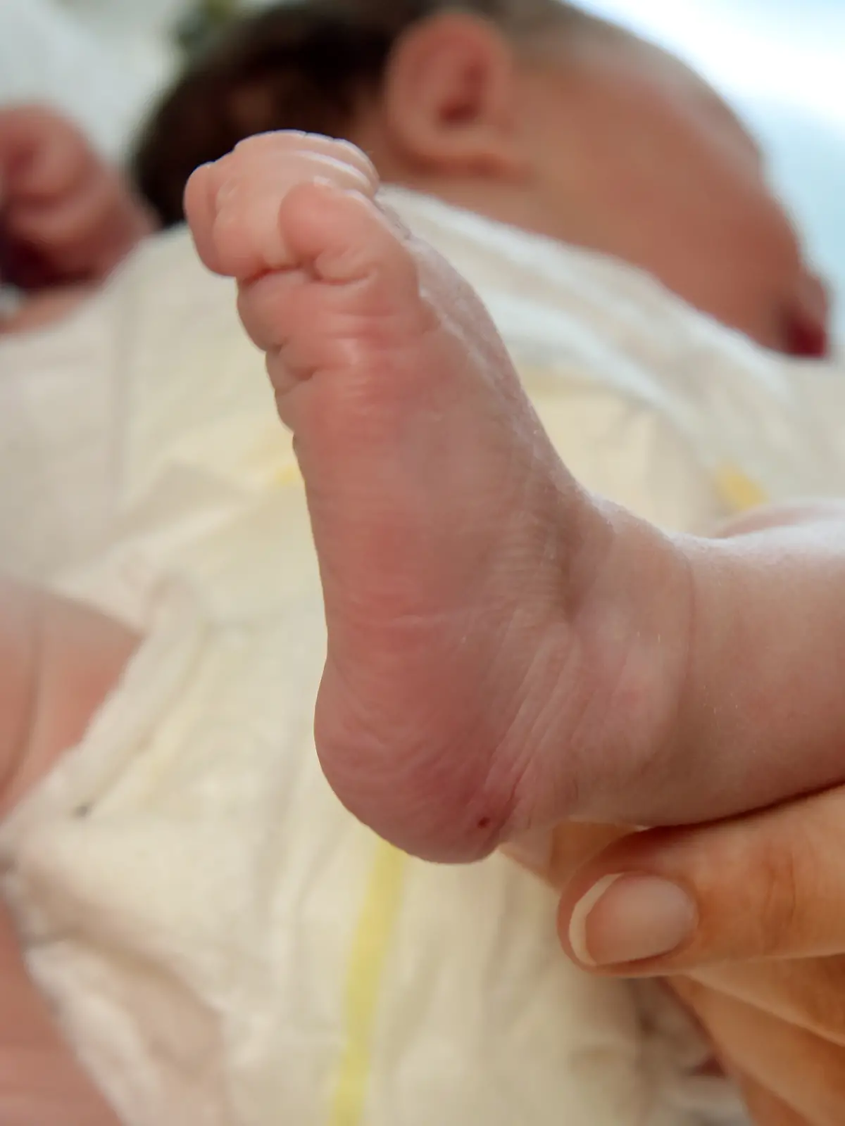 Bild zu: "„Blitz”-Geburt – dieses Aachener Baby hat’s super eilig"