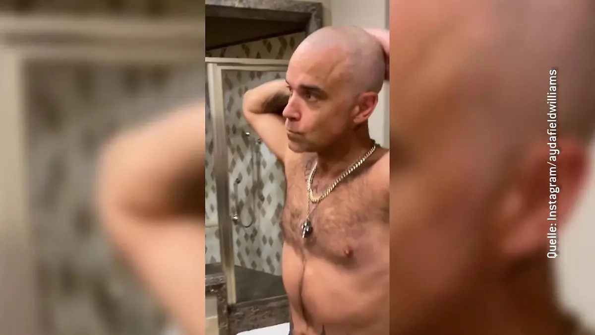 Robbie Williams verabschiedet sich von seinen Haaren Glatze für den Sänger