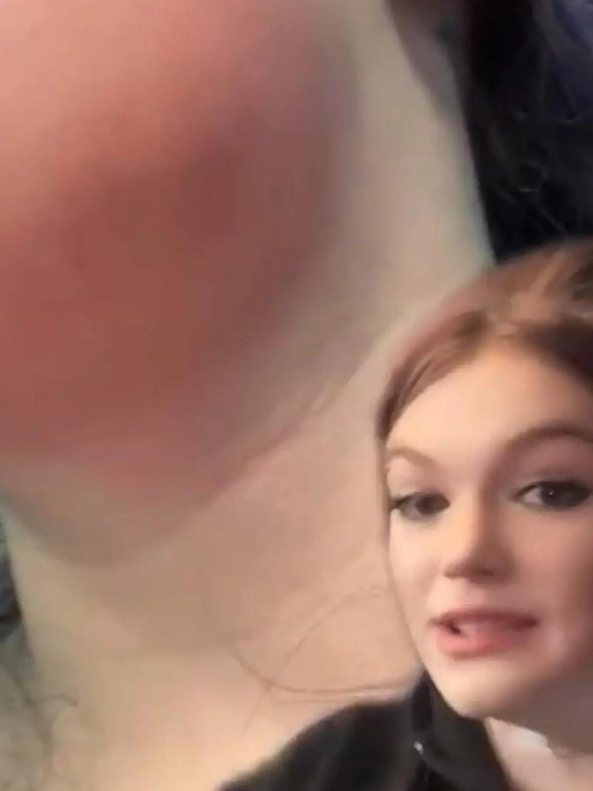 Bild zu: "Courtney (19) stirbt beinahe – weil ihr ein Zahn abbricht!"
