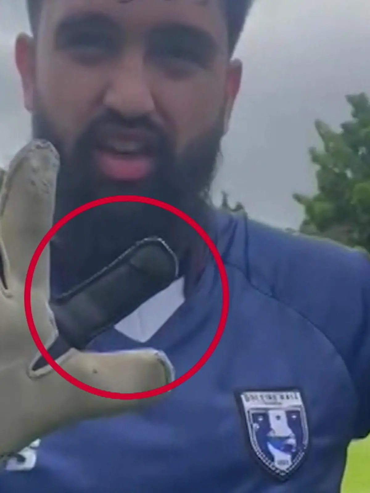 João de Assis ist ein Torwart aus Brasilien und hat zwölf Finger.