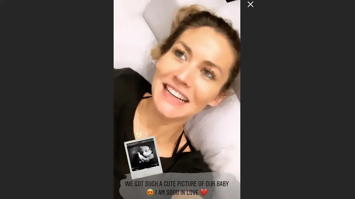 Hier zeigt Fiona Erdmann ein neues 3D-Ultraschallbild ihres Babys.