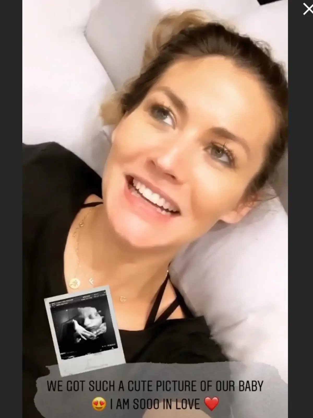 Hier zeigt Fiona Erdmann ein neues 3D-Ultraschallbild ihres Babys.