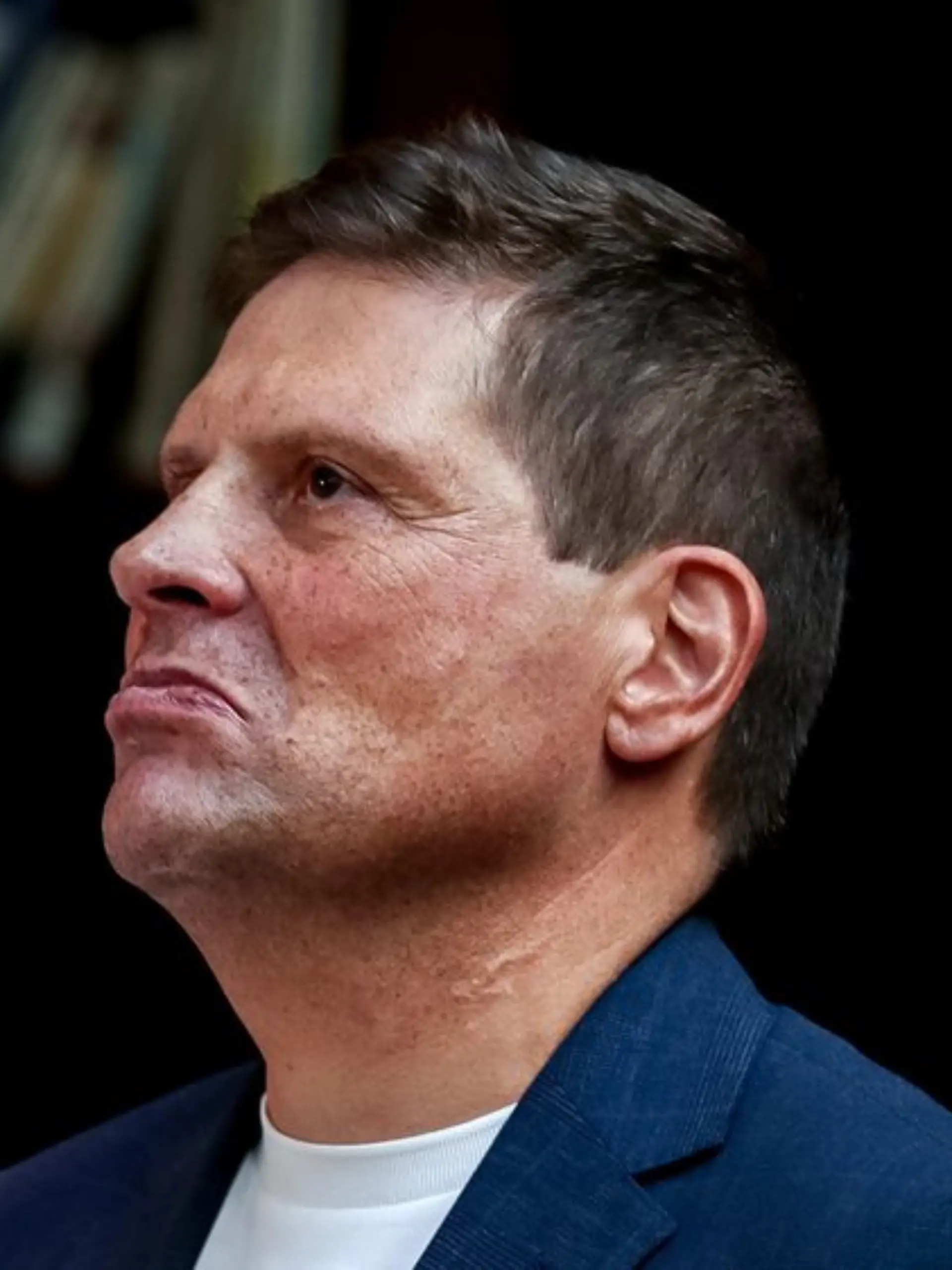 Bild zu: "Jan Ullrich meldet sich nach Unfall-Schock aus dem Kanrkenhaus"