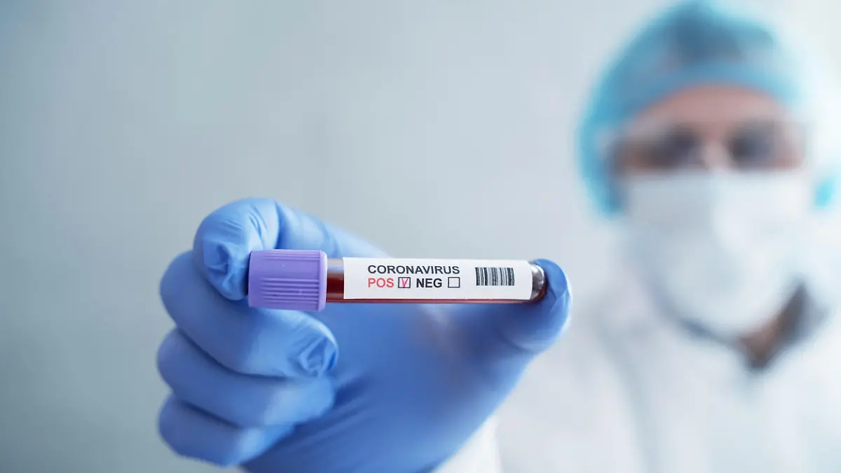 Coronavirus-Bluttest im Krankenhauslabor
