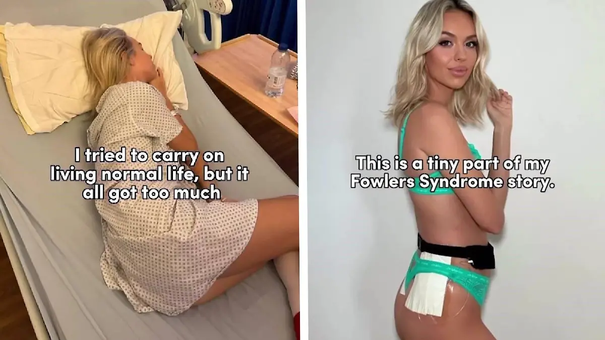 Elle Adams (30) hat seltene Erkrankung