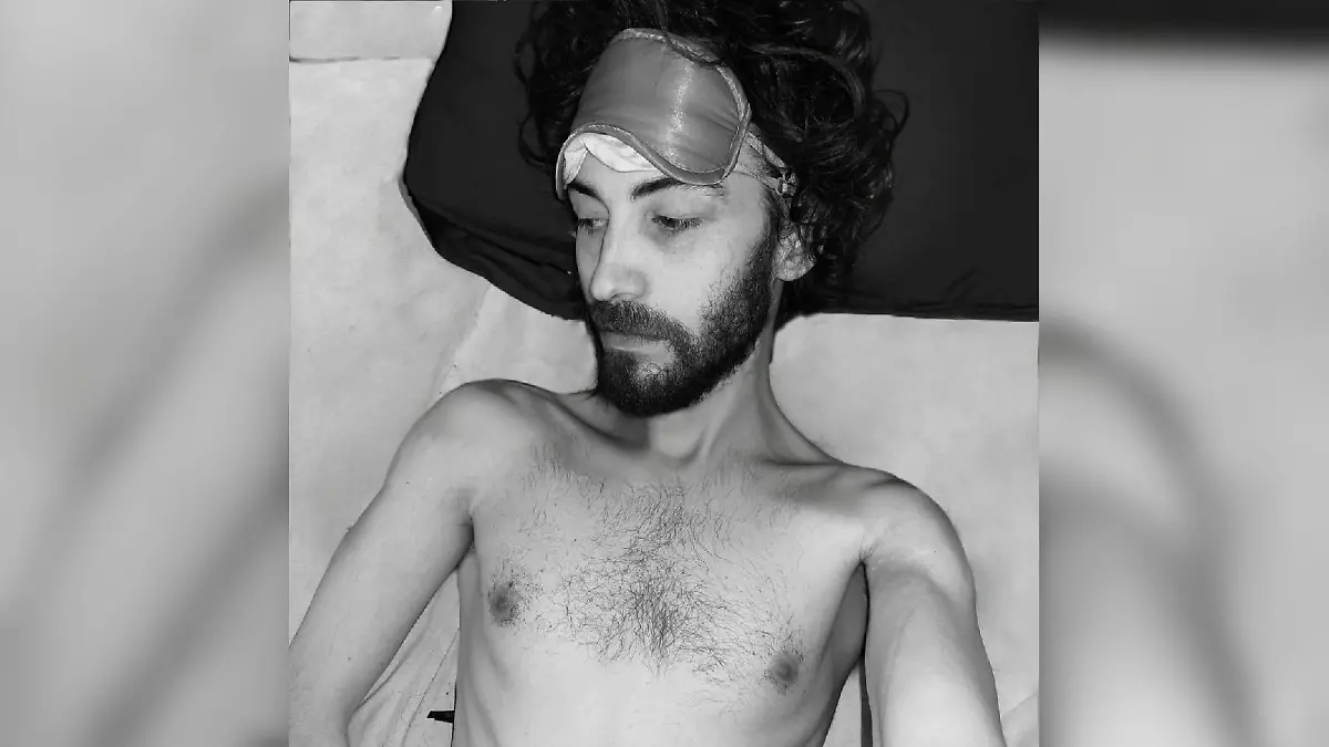ME/CFS: Weil sich Tobias Schweikert seit Jahren nicht mehr bewegen kann, haben sich seine Muskeln zurückgebildet.