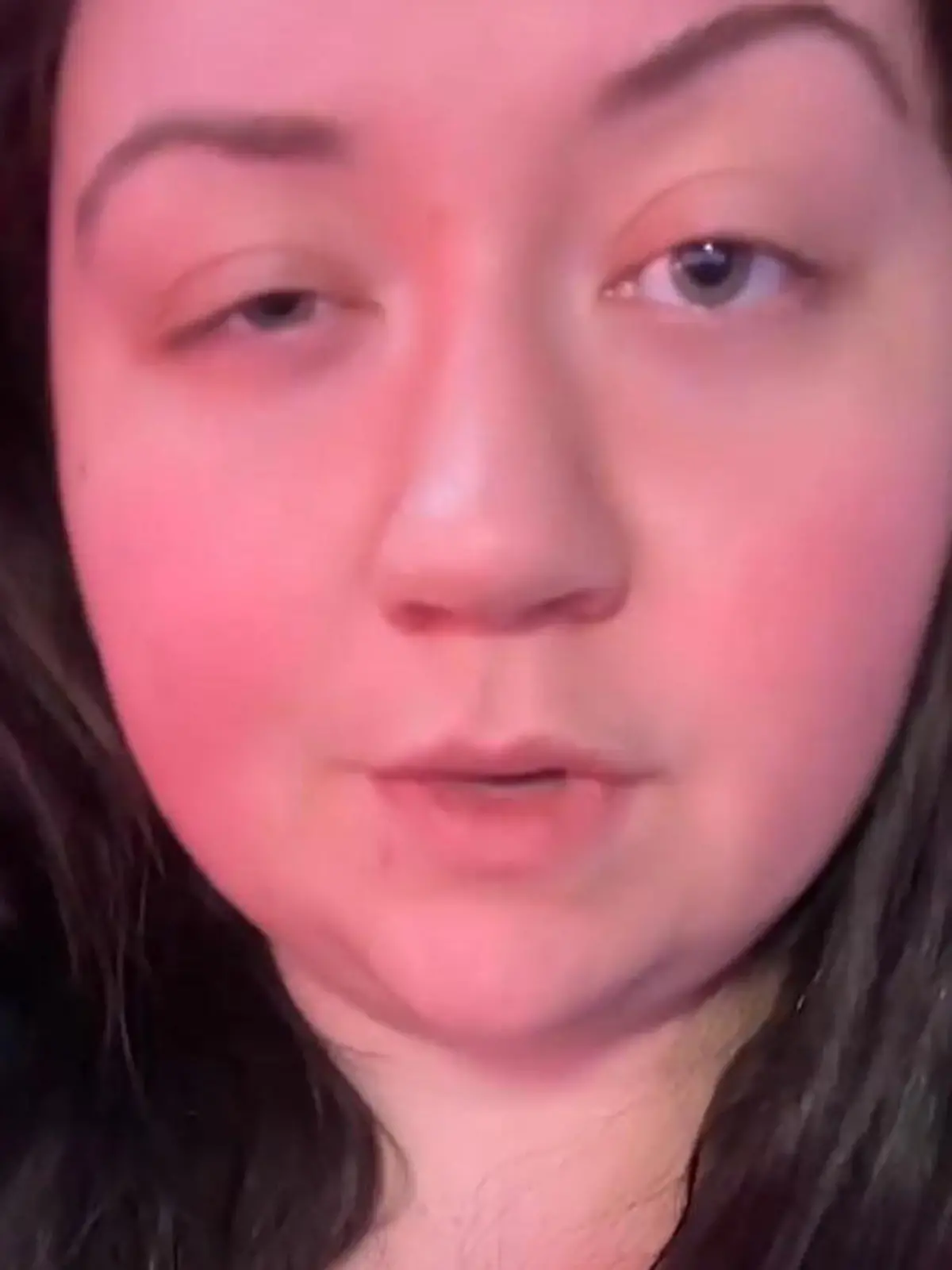 Bild zu: "Ärzte werfen ihr Täuschung vor! Lyndsi (30) leidet an seltener Erkrankung"