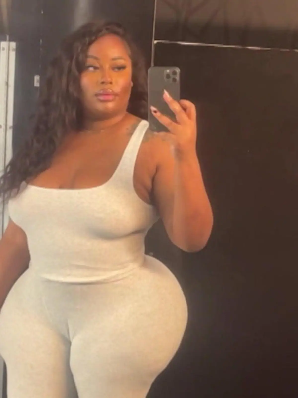 Bild zu: "Not-OPs und Bluttransfusionen! Dieser Beauty-Eingriff kostet Influencerin fast das Leben"