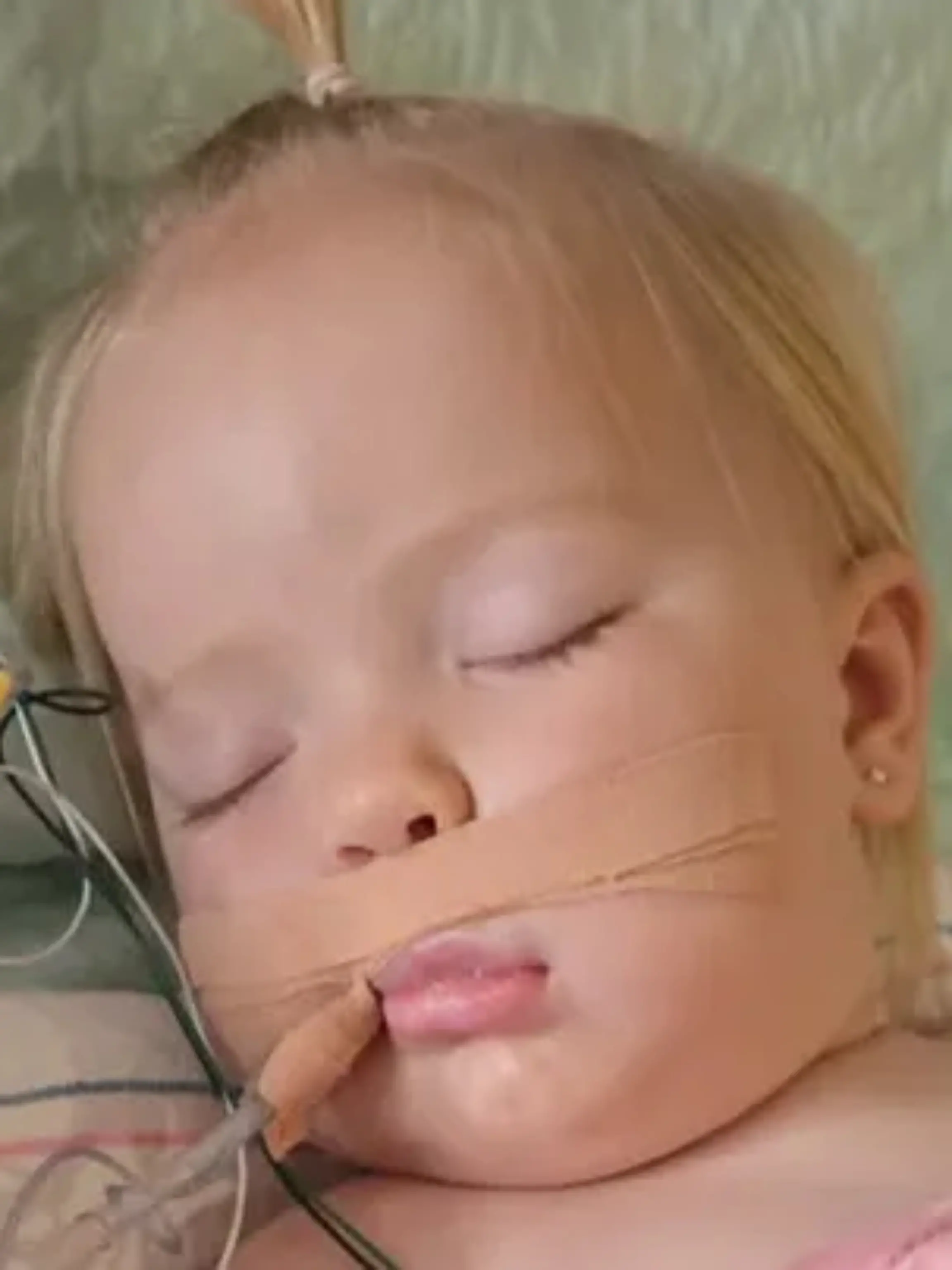 Cara Reed (1) wird nach dem Biss einer Klapperschlange im Krankenhaus behandelt