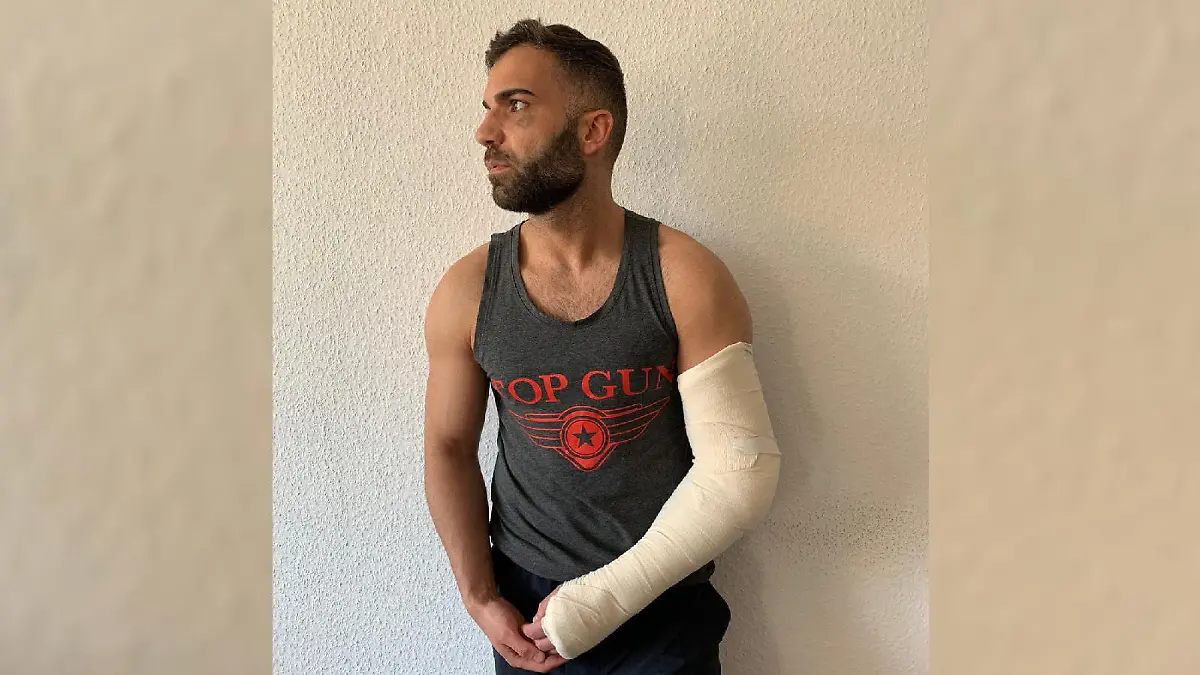 Rafi Racheks Verletzungen nach der homophoben Attacke in Köln