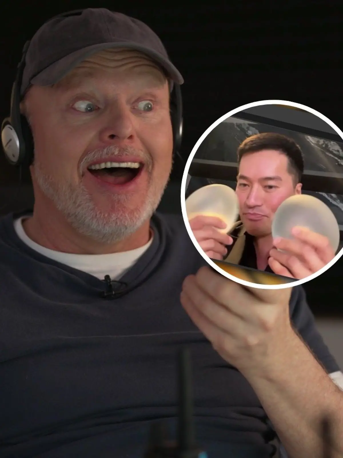 Chirurg empfiehlt Stefan Raab Beauty-Eingriff