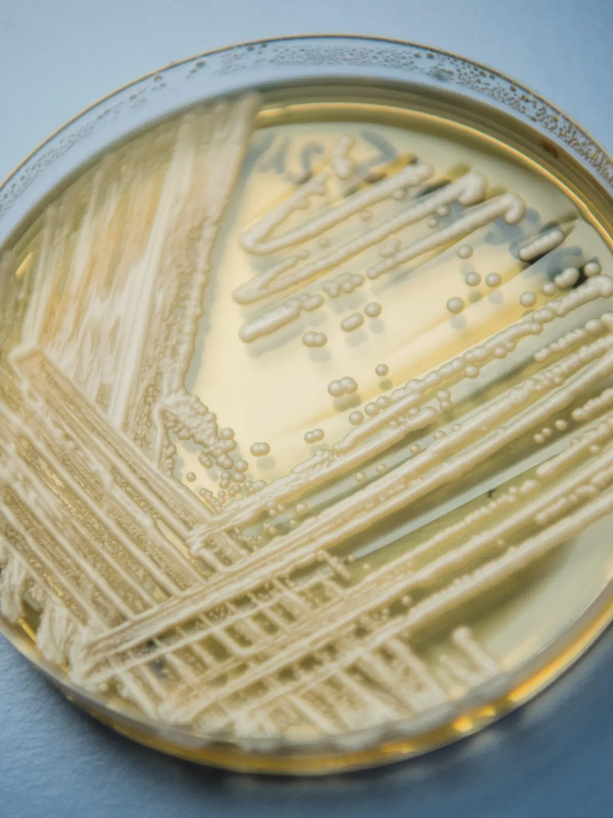 ARCHIV - 23.01.2018, Bayern, Würzburg: Der Hefepilz Candida auris in einer Petrischale, aufgenommen in einem Labor der Universität in Würzburg. Die Weltgesundheitsorganisation (WHO) ist besorgt über 19 kranheitserregende Pilze, die nach Expertenansicht die öffentliche Gesundheit bedrohen. (zu dpa «WHO warnt vor lebensgefährlichen Pilzerkrankungen») Foto: Nicolas Armer/dpa +++ dpa-Bildfunk +++