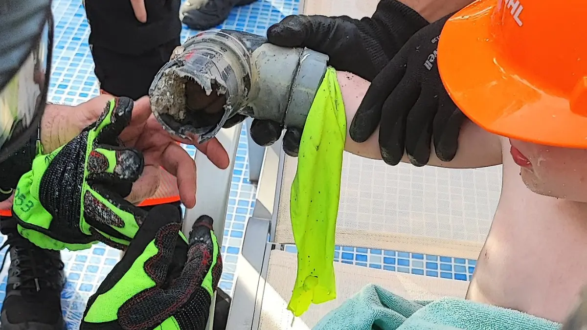 Mallorca: Arm in Hotelpool angesaugt