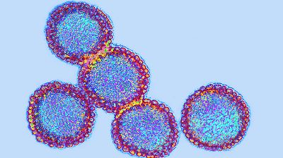 Massive Grippewelle durch H3N2-Virus? Neue Influenza-Mutation breitet sich in Deutschland aus!