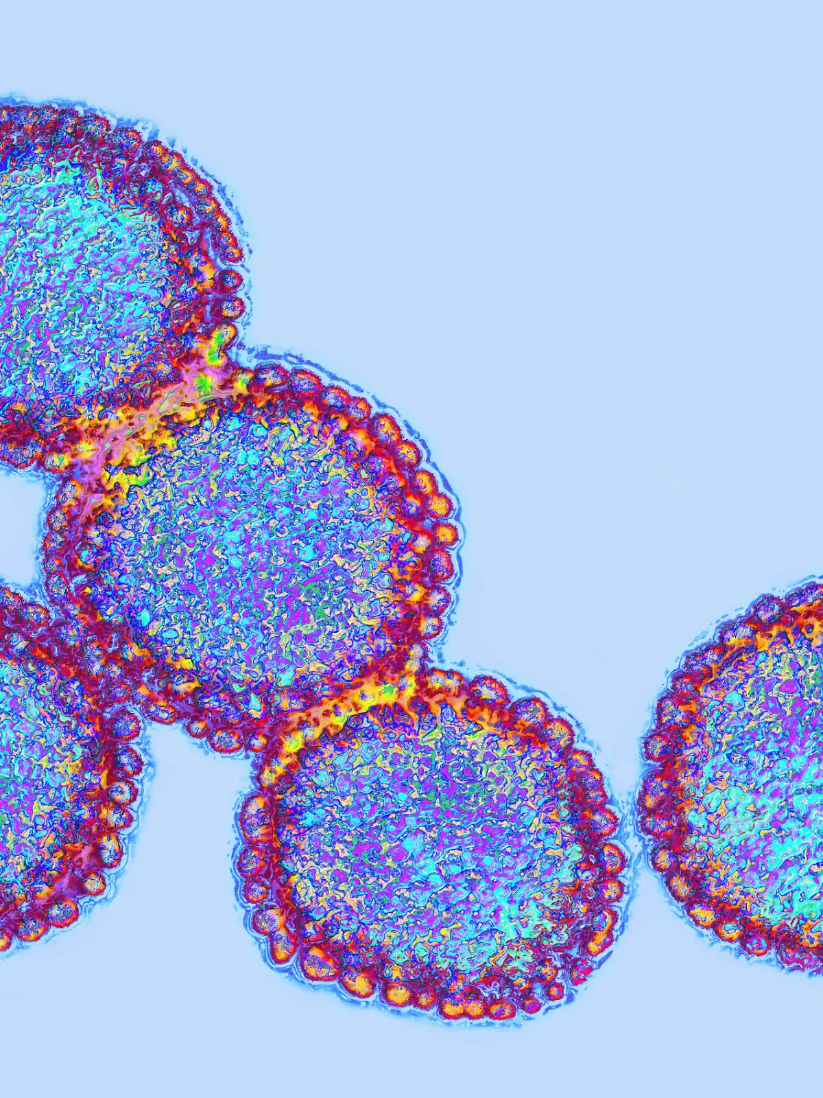 Influenza-Virus