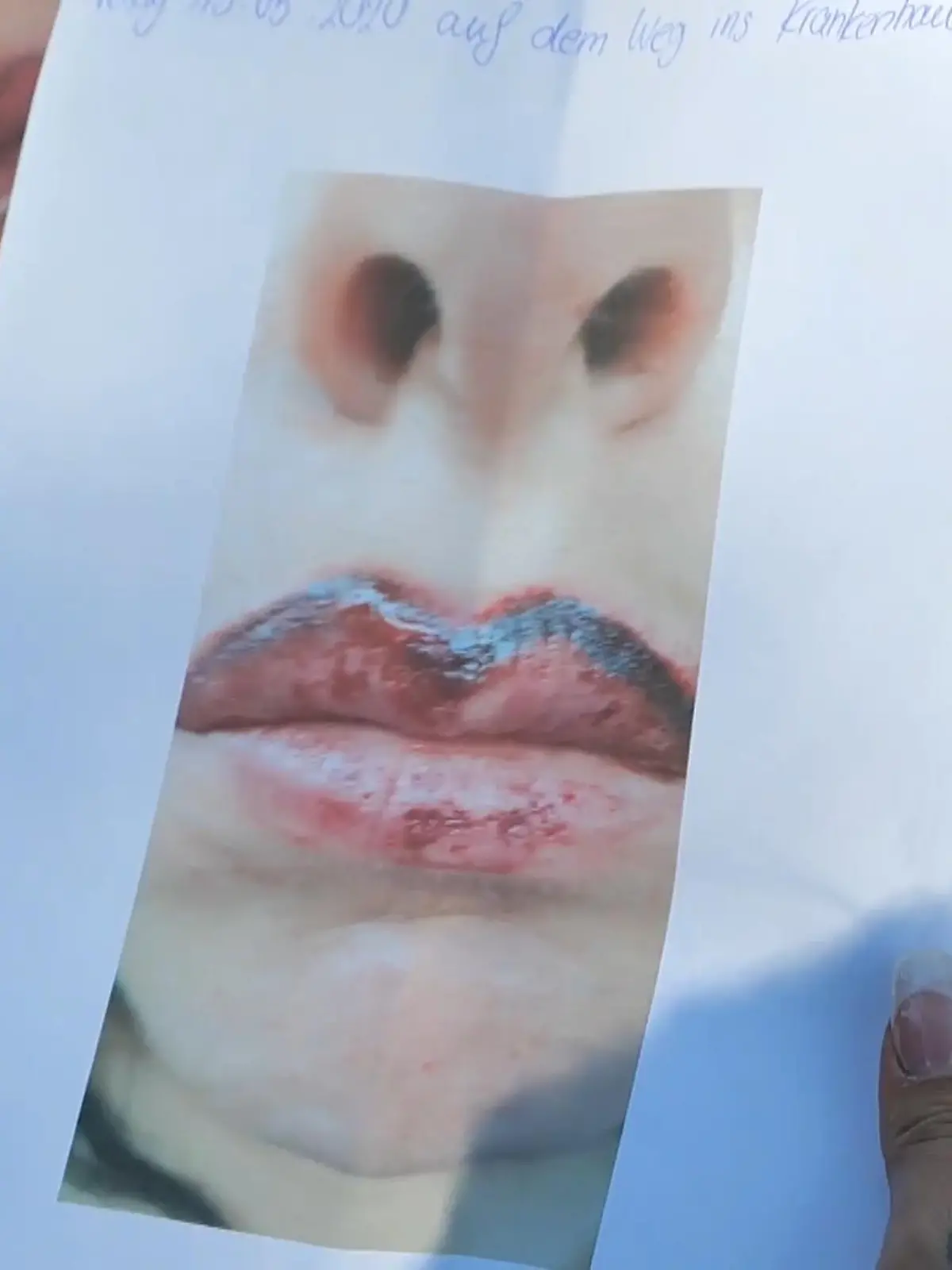 Diana wollte dauerhaft schöne rote Lippen - und bekam stattdessen Schmerzen und ein Grusel-Ergebnis, dank dem sogar ihr Sohn vor ihr Angst hatte. Wie konnte es zu so einem Pfusch kommen? Im Video konfrontiert unser Reporter die Kosmetikerin.