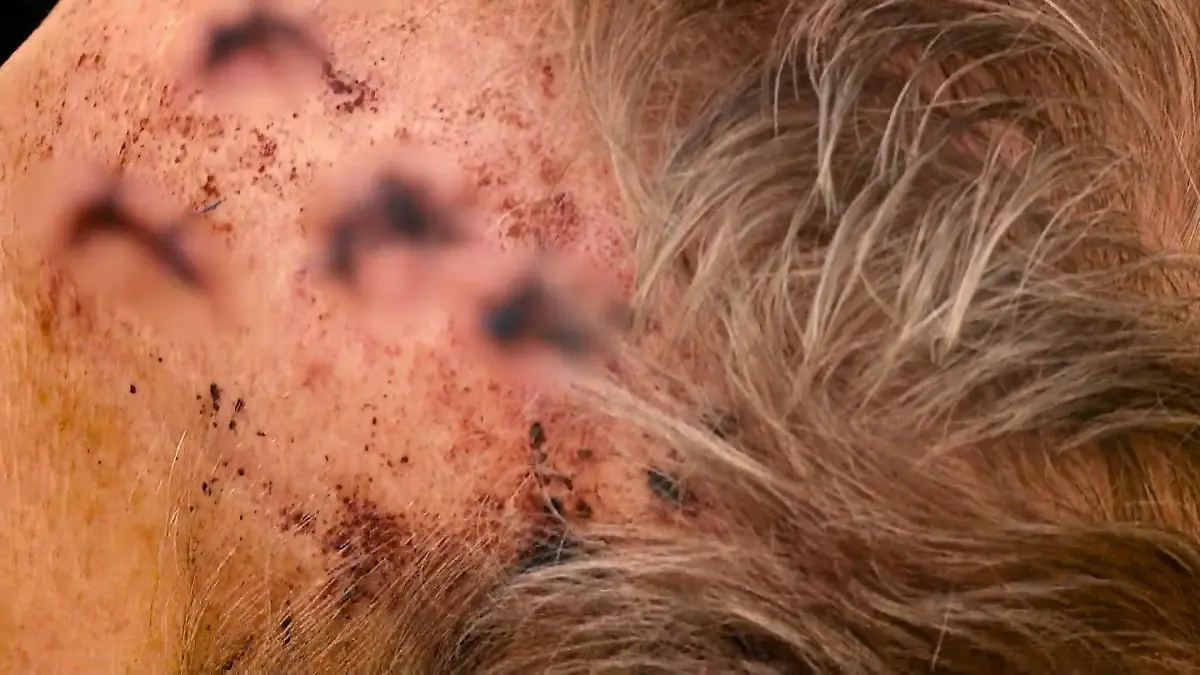 Hans-Joachim E. wurde schwer am Kopf verletzt.