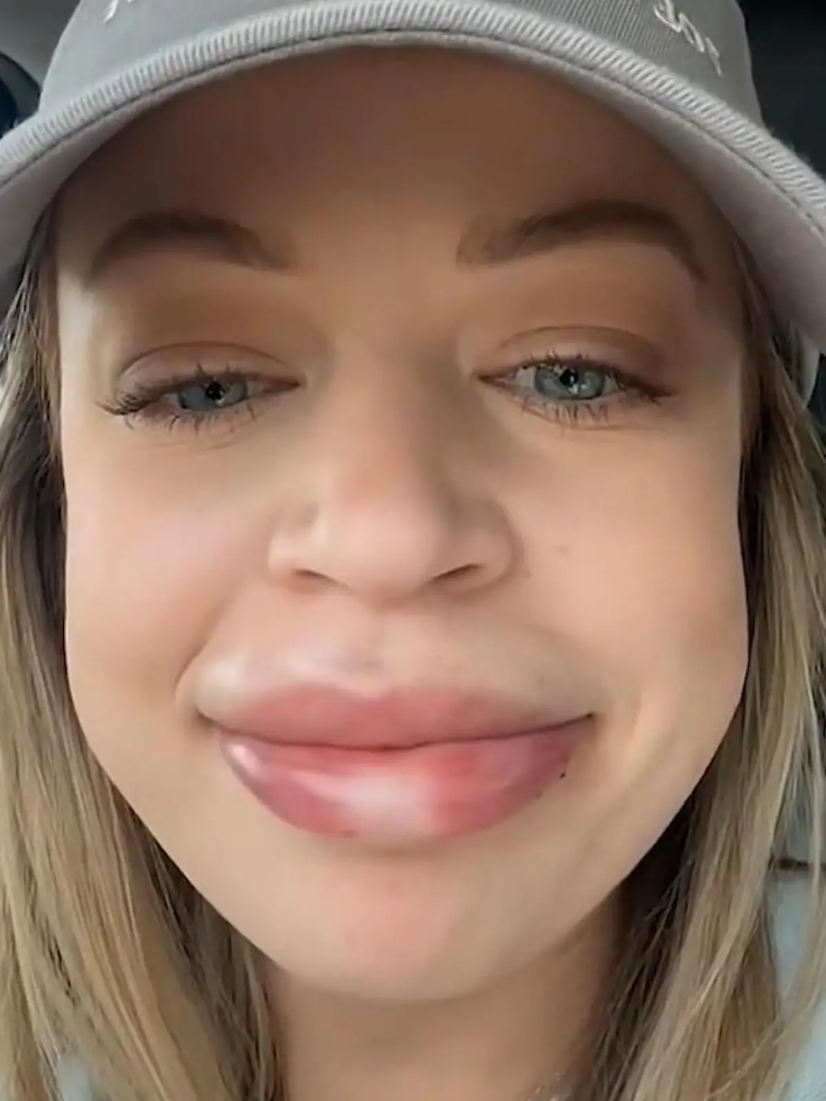 Ashley (29) will natürliche Schönheit und kassiert XXL-Lippe 