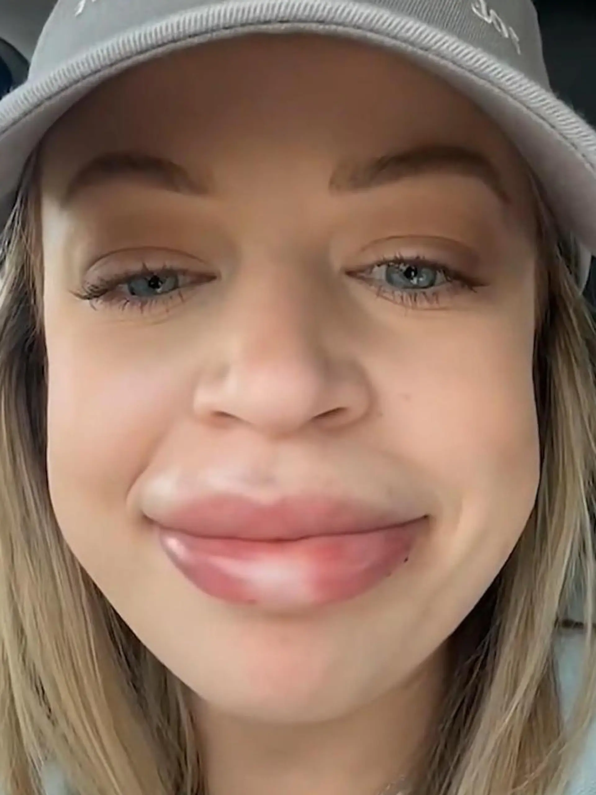 Ashley (29) will natürliche Schönheit und kassiert XXL-Lippe 