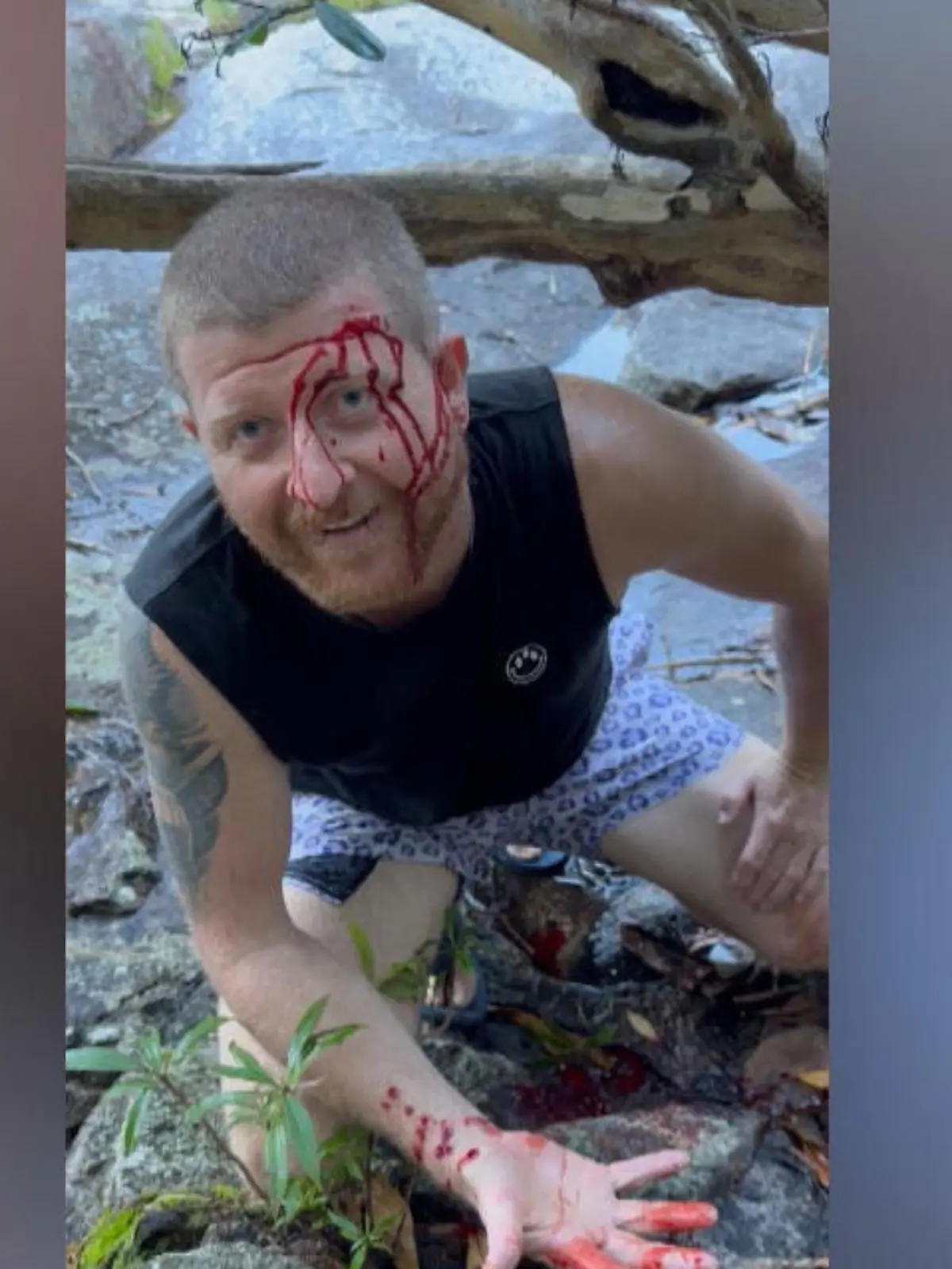 Damit hat er nicht gerechnet! Als Joel Herrington – auch bekannt als Joey Zane – im australischen Queensland unterwegs ist, wird er beim Spazieren plötzlich von einer Schlange attackiert – und in den Kopf gebissen. 