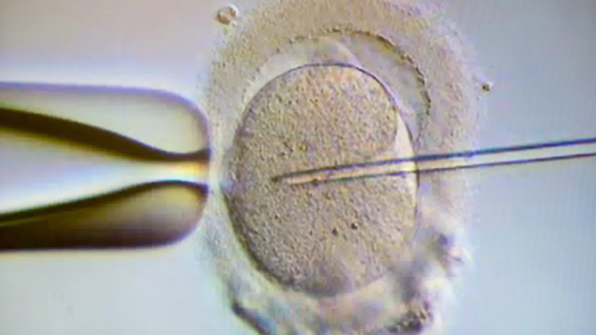 Ärztlicher Betrug bei Kinderwunschbehandlung: Familie erfährt erst Jahre später von Fremdsperma. (Symbolbild)