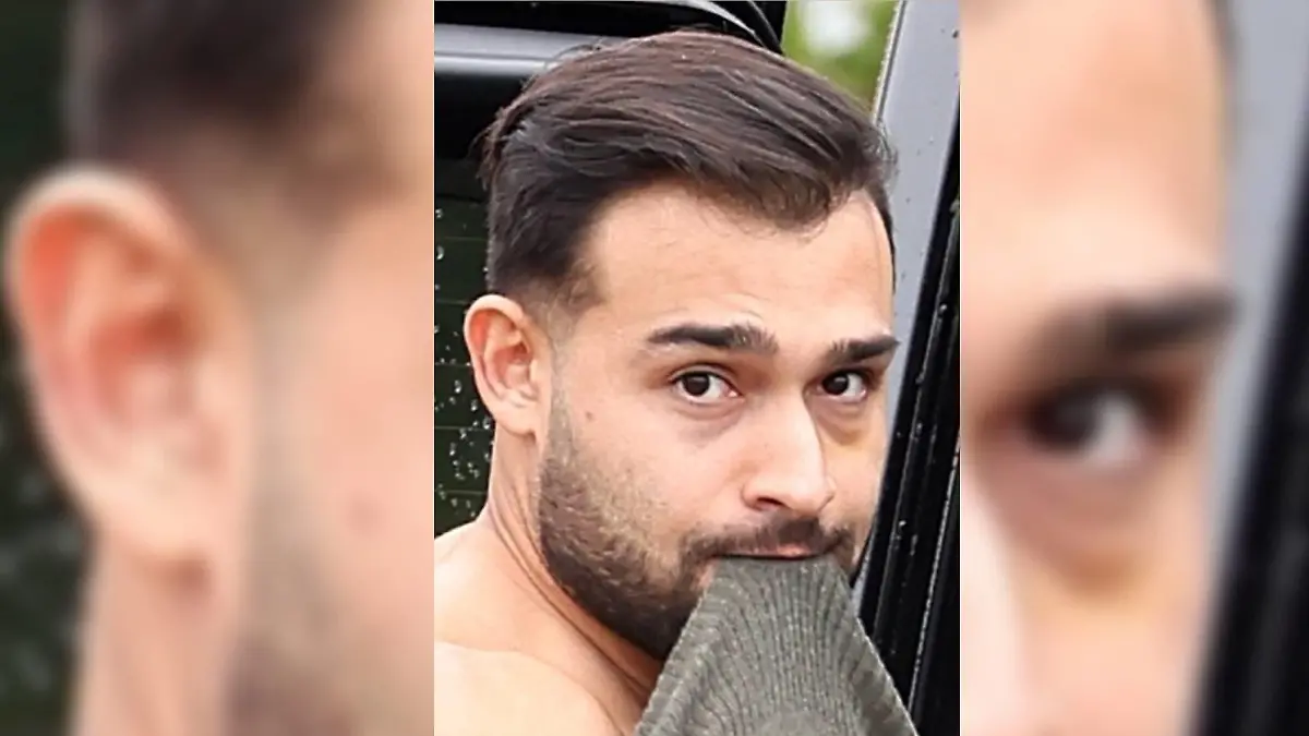 Anfang des Jahres wurde Sam Asghari von Fotografen mit einem blauen Auge abgelichtet.