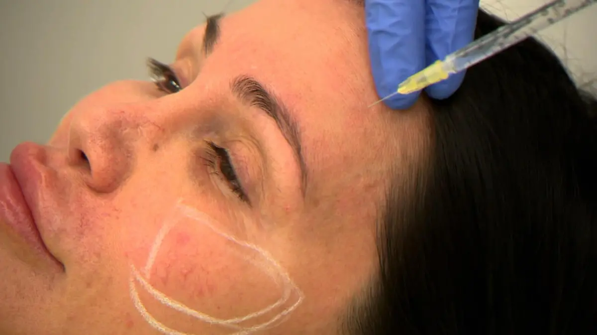 Djamila Rowe hat Sehsucht nach Beauty-Doc „Ich bin um 10 Jahre gealtert“