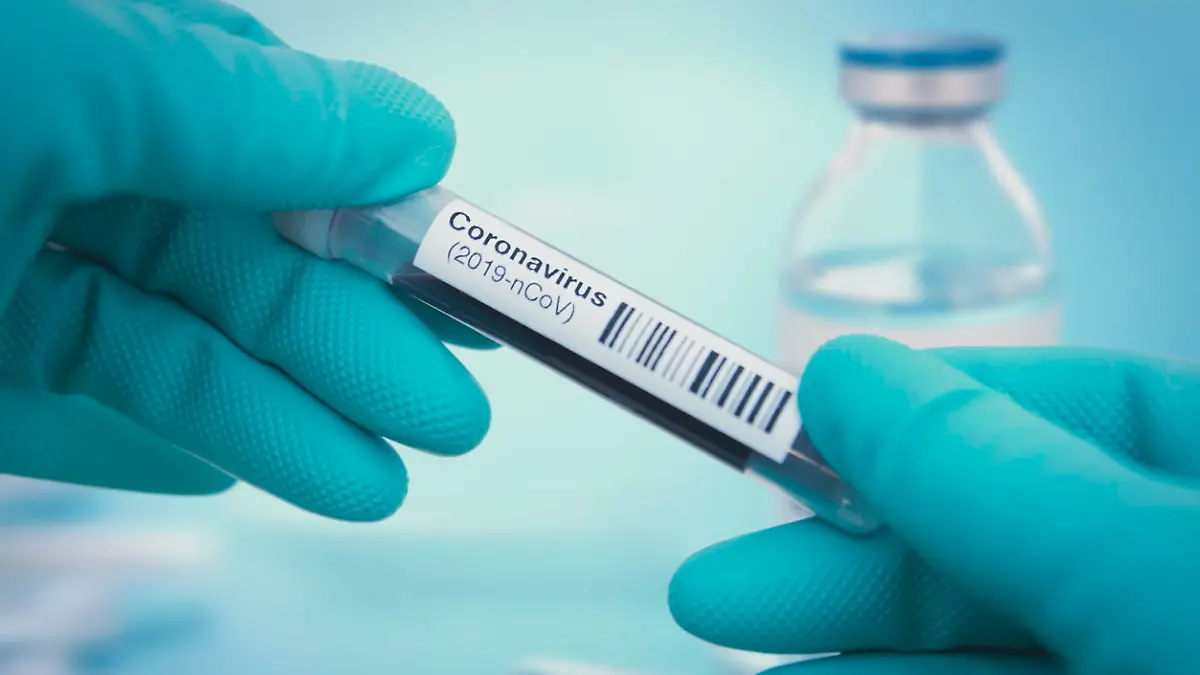 Coronavirus-Test