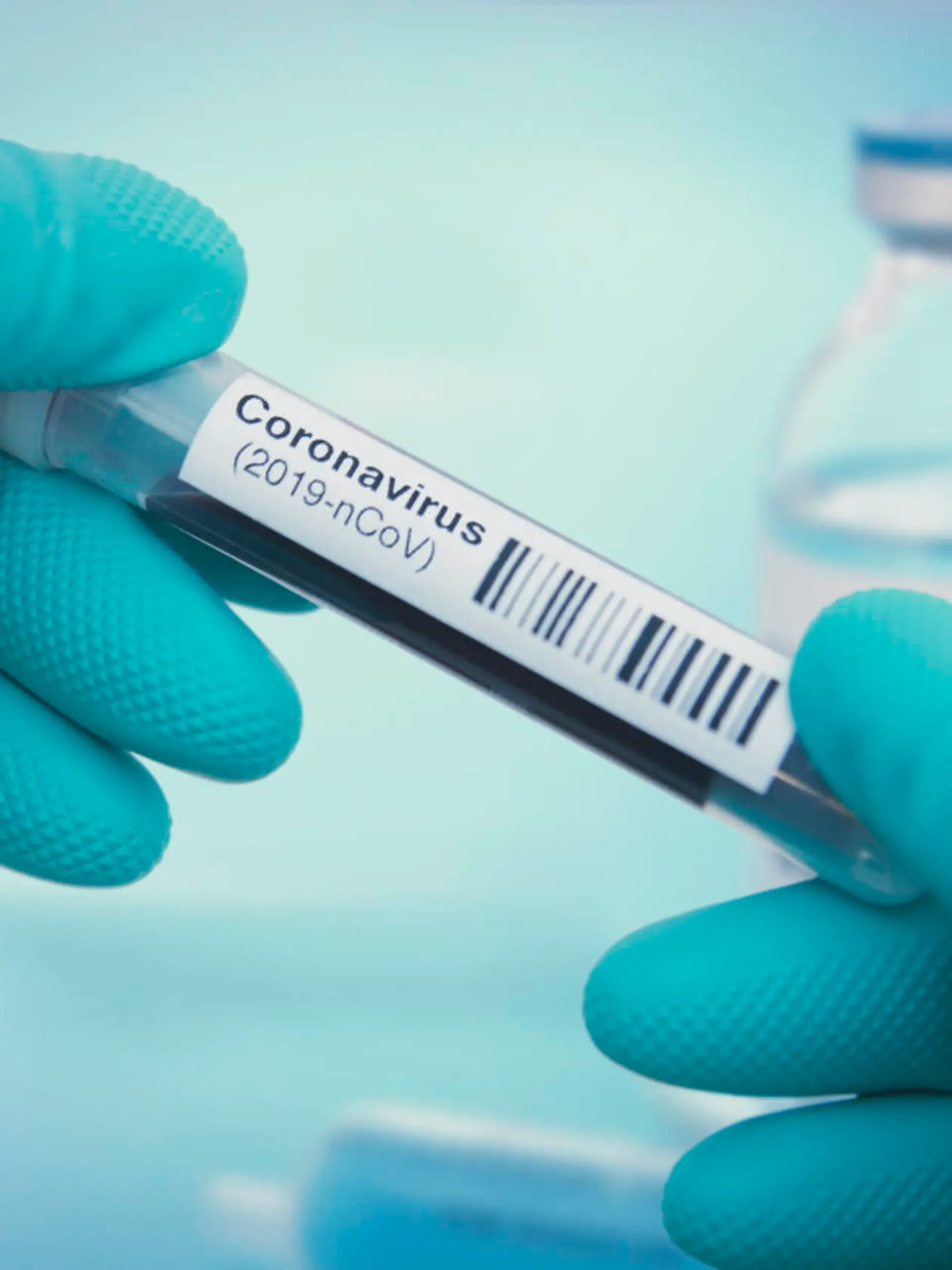 Coronavirus-Test