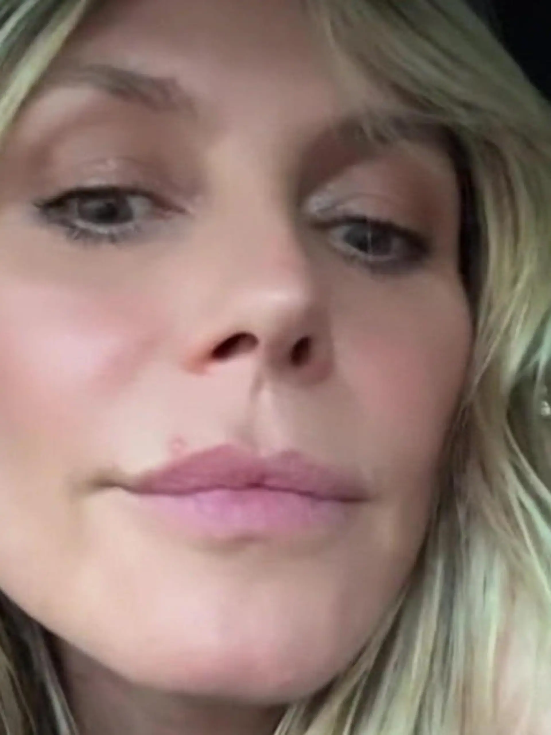 Bild zu: "Heidi Klum hat ein Pickel-Problem - kurz vor „Germany’s Next Topmodel”-Finale "