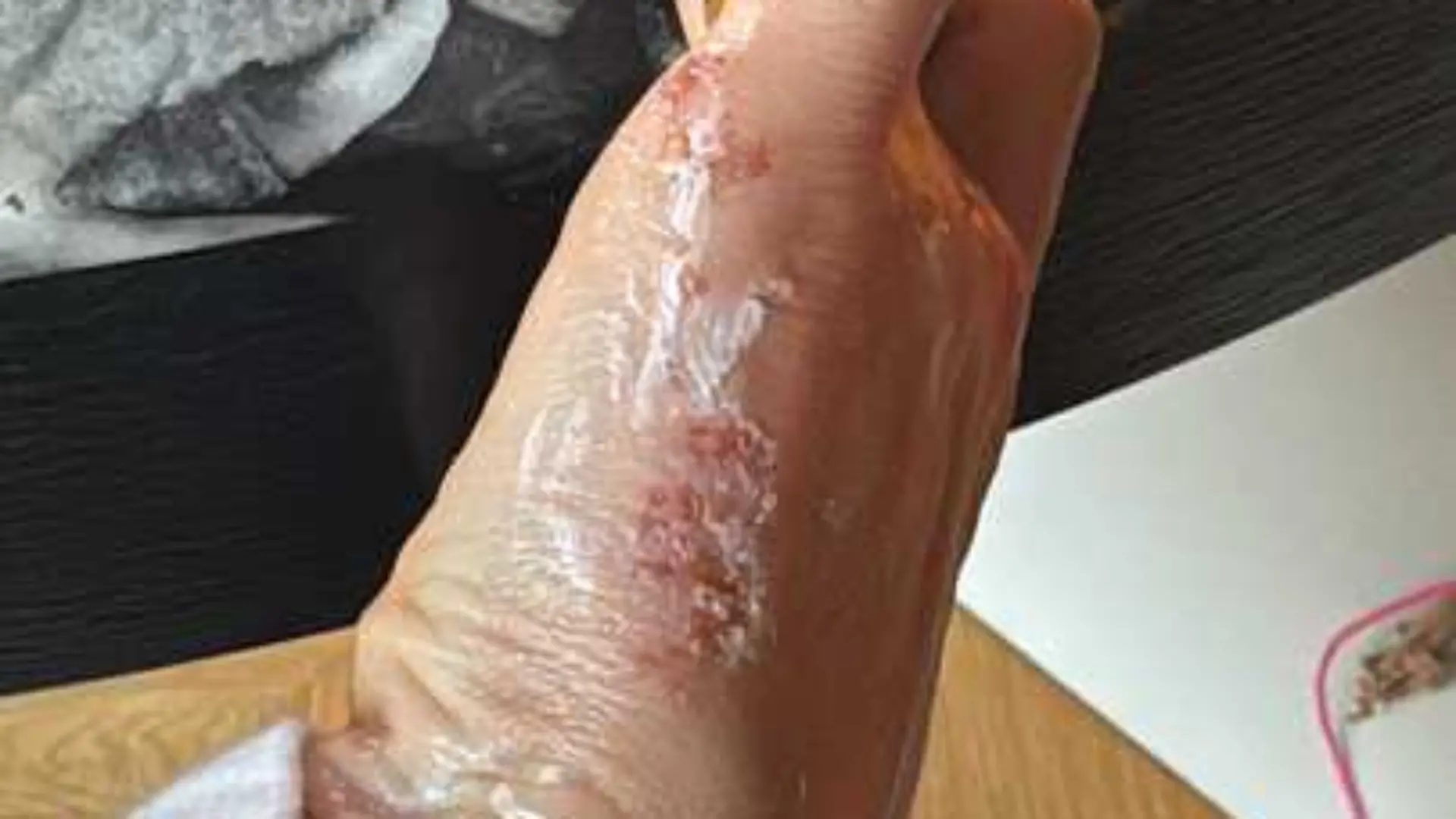 Auch die Hand von Cathy ist ganz dick. Am Freitag geht es ins MRT.