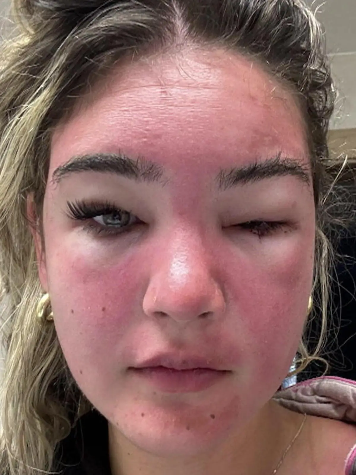 Vier Hufe statt zwei Räder: Die hat doch’n Rad ab! Kuh nimmt an ... Vier Hufe statt zwei Räder: Die hat doch’n Rad ab! Kuh nimmt an ...