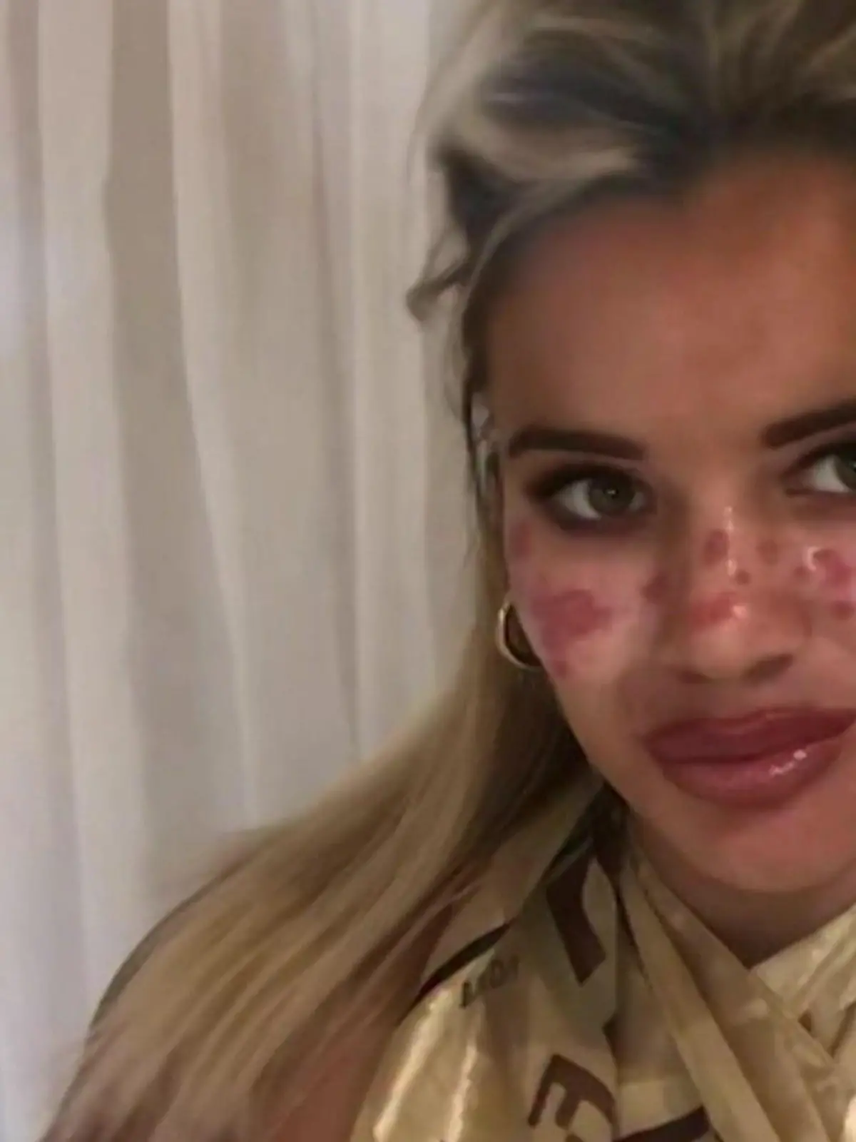 Bild zu: "Bei ihr ging ALLES schief! Moderatorin bereut Beauty-Eingriffe - für 50.000 Euro"